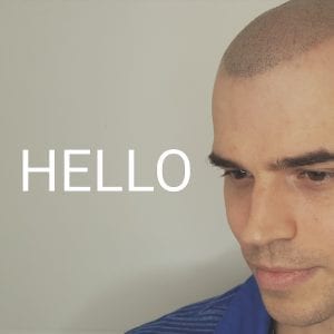 Scalp Micropigmentation Hairline
