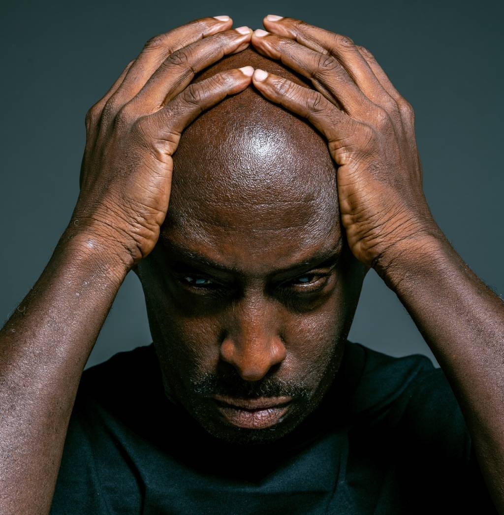 What are the treatments for hair loss